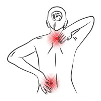 כאב עצבי (נוירופתי)